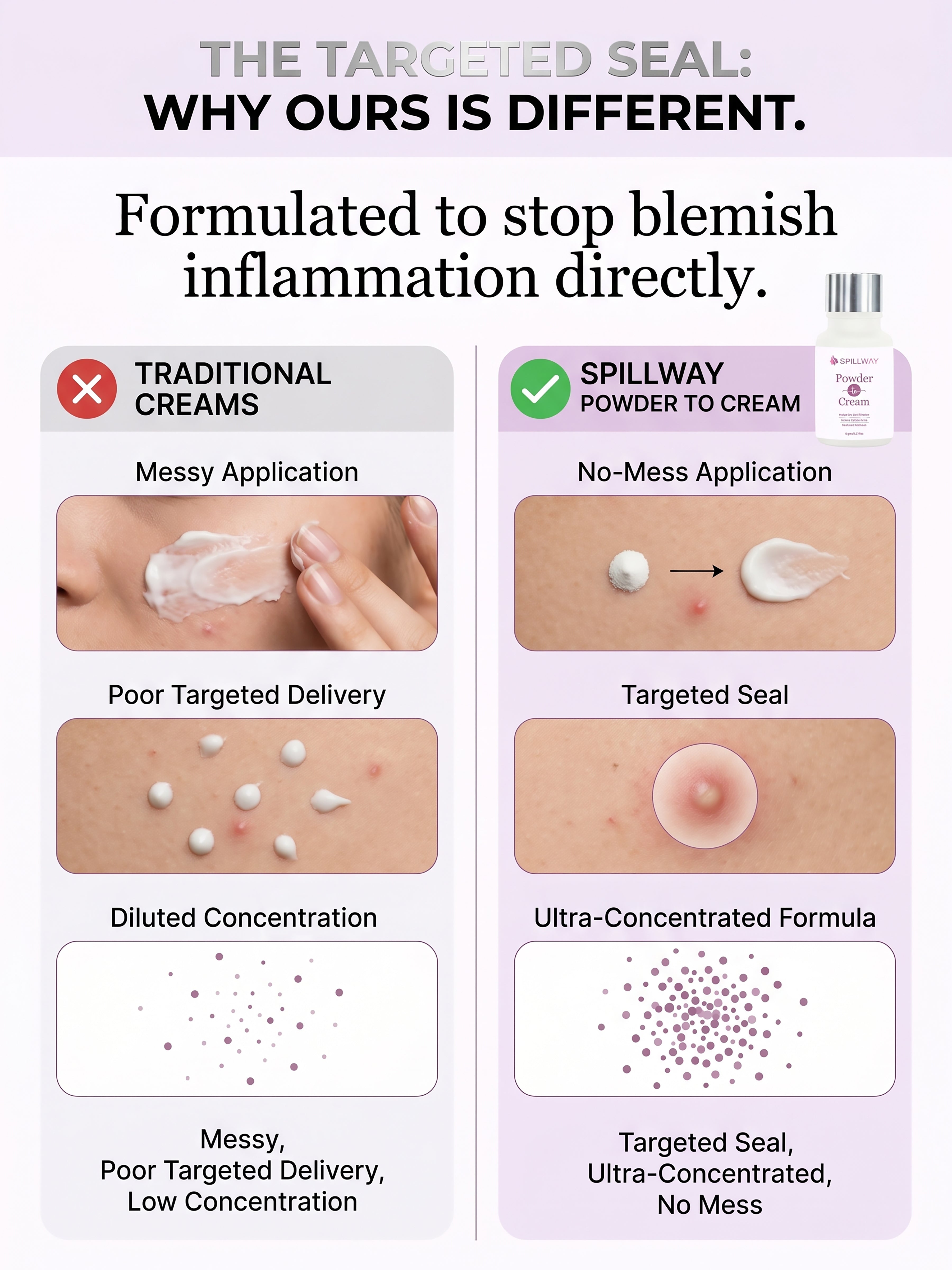 Spillway Acne Control Powder to Cream Treatment